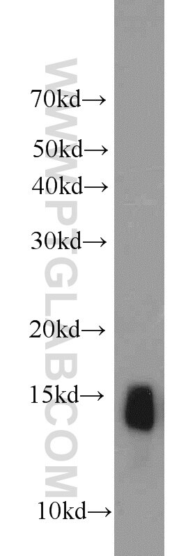 Western Blot (WB) analysis of mouse pancreas tissue using NHP2L1 Polyclonal antibody (15802-1-AP)