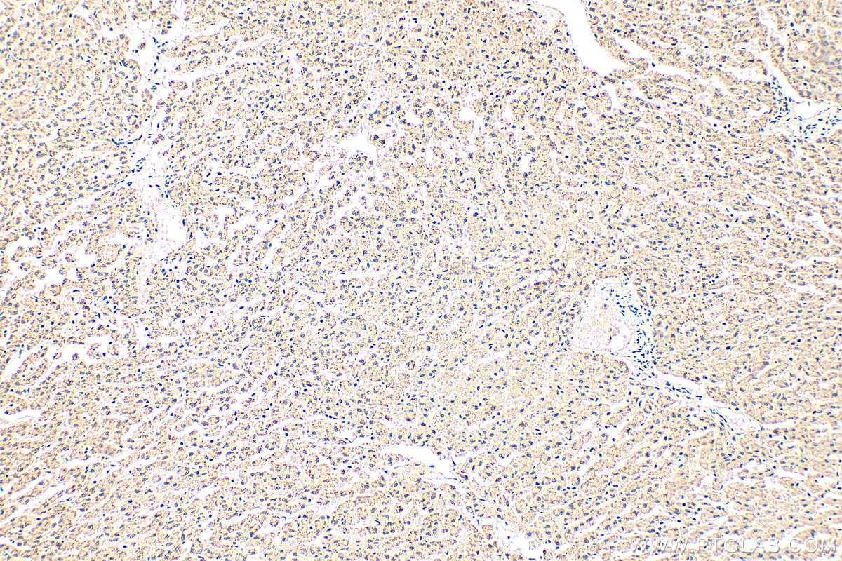 Immunohistochemistry (IHC) staining of human liver tissue using NHS Polyclonal antibody (31487-1-AP)