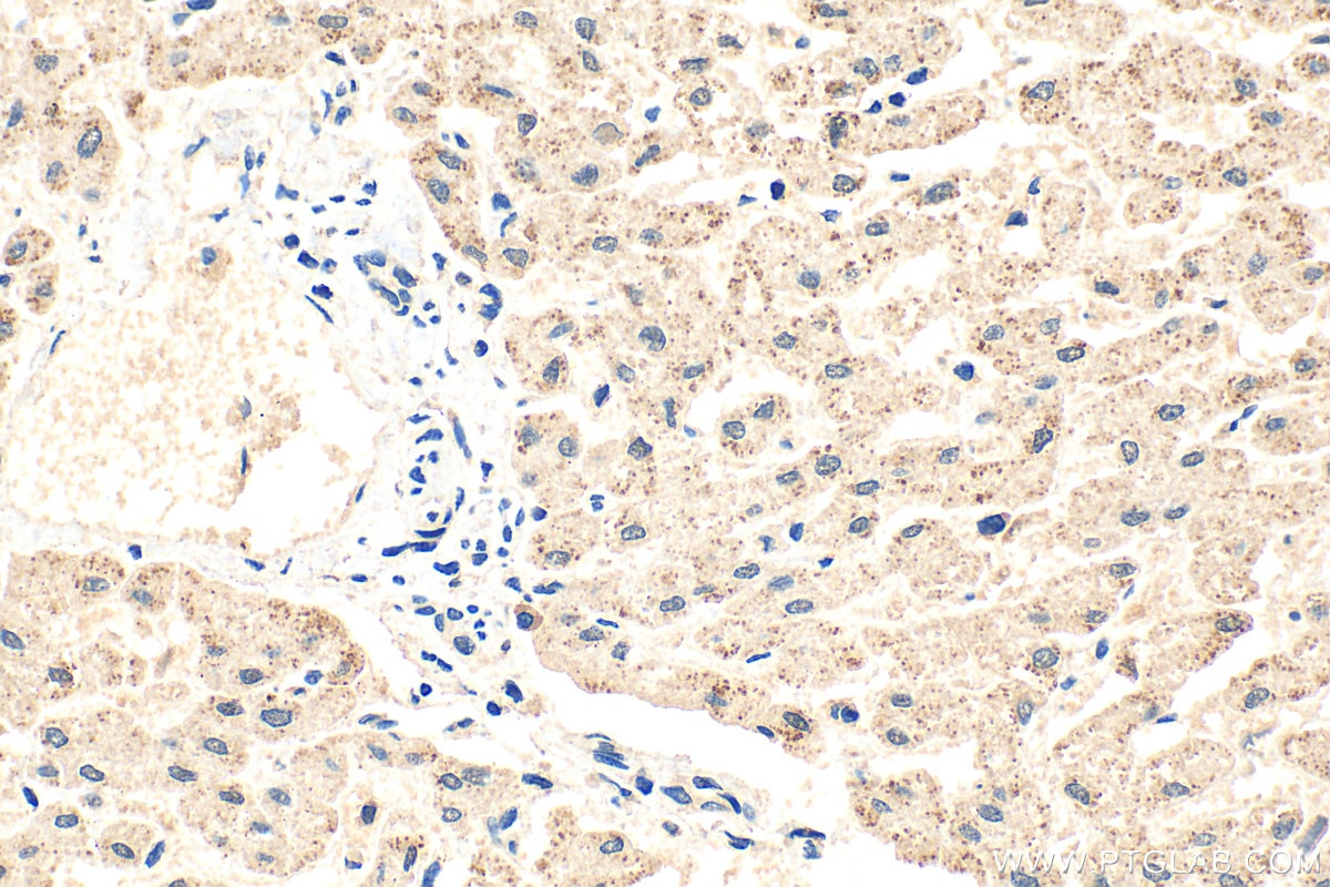 Immunohistochemistry (IHC) staining of human liver tissue using NHS Polyclonal antibody (31487-1-AP)