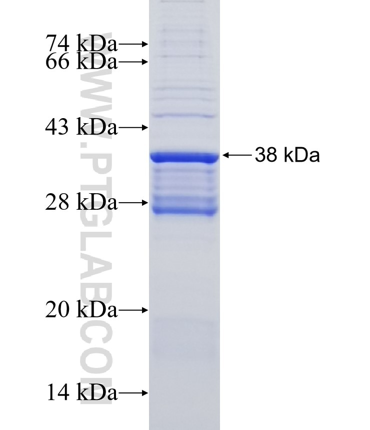 NIACR1 fusion protein Ag12425 SDS-PAGE
