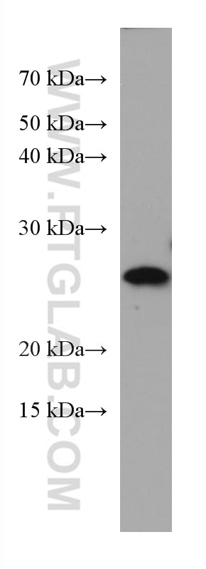 Western Blot (WB) analysis of NCCIT cells using NICN1 Monoclonal antibody (67328-1-Ig)