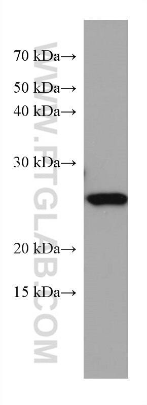 WB analysis of U-251 using 67328-1-Ig