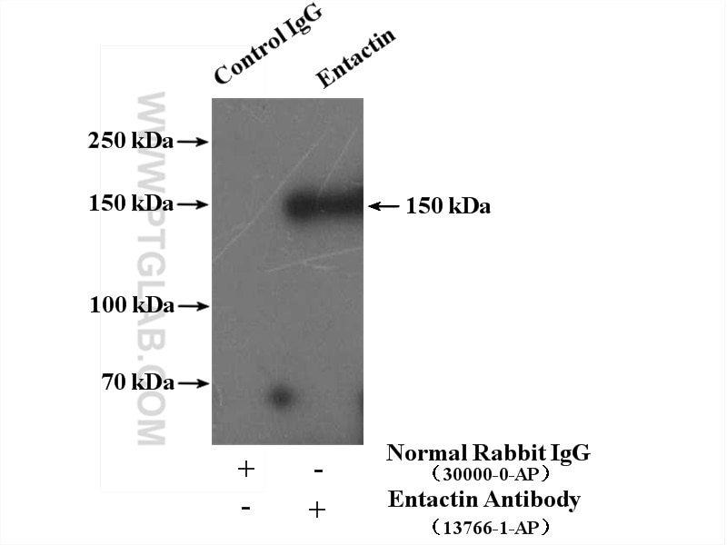 Immunoprecipitation (IP) experiment of human placenta tissue using Entactin Polyclonal antibody (13766-1-AP)