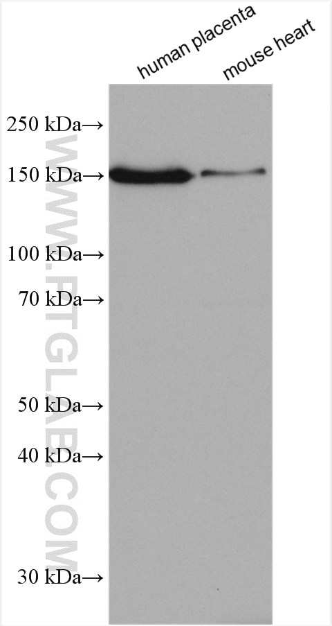 Western Blot (WB) analysis of various lysates using Entactin Polyclonal antibody (13766-1-AP)