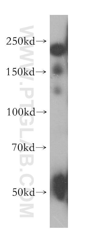Western Blot (WB) analysis of human heart tissue using Nidogen 2 Polyclonal antibody (13530-1-AP)