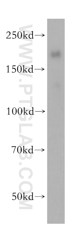 Western Blot (WB) analysis of human placenta tissue using Nidogen 2 Polyclonal antibody (13530-1-AP)
