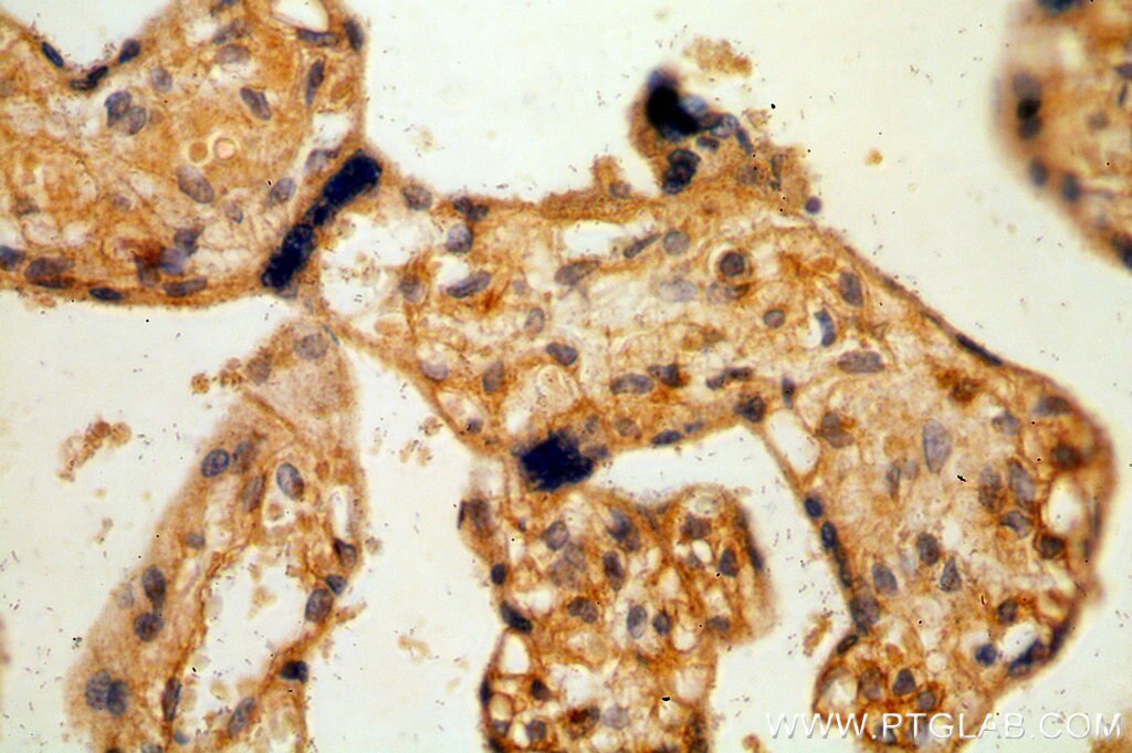 Immunohistochemistry (IHC) staining of human placenta tissue using Nidogen 2 Polyclonal antibody (19076-1-AP)