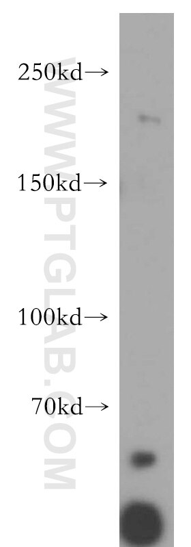 Western Blot (WB) analysis of mouse heart tissue using Nidogen 2 Polyclonal antibody (19076-1-AP)