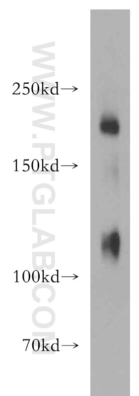 Western Blot (WB) analysis of human placenta tissue using Nidogen 2 Polyclonal antibody (19076-1-AP)