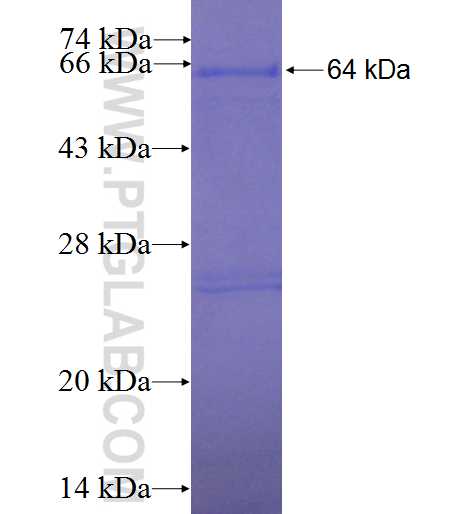 NIF3L1 fusion protein Ag0819 SDS-PAGE