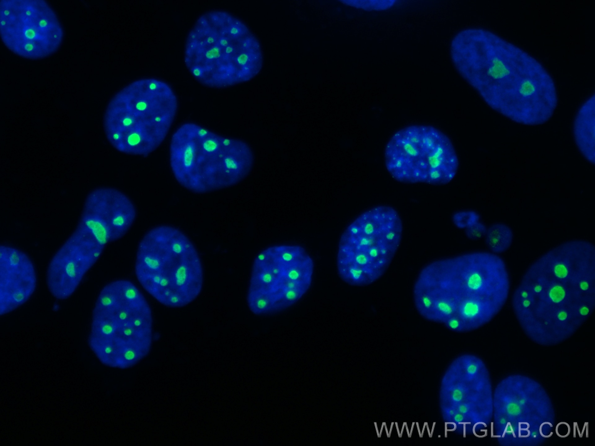 IF Staining of MCF-7 using CL488-12615