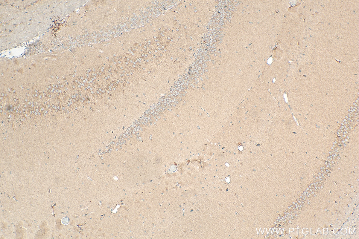 IHC staining of mouse brain using 13007-1-AP
