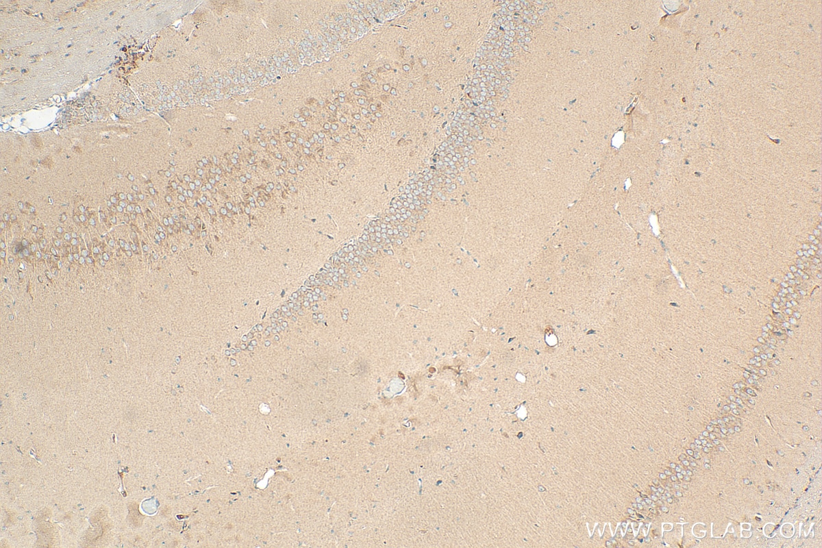 Immunohistochemistry (IHC) staining of mouse brain tissue using Ninein Polyclonal antibody (13007-1-AP)