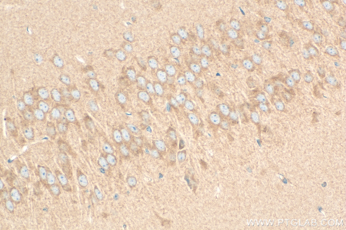 Immunohistochemistry (IHC) staining of mouse brain tissue using Ninein Polyclonal antibody (13007-1-AP)