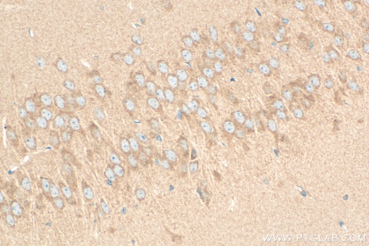 Immunohistochemistry (IHC) staining of mouse brain tissue using Ninein Polyclonal antibody (13007-1-AP)