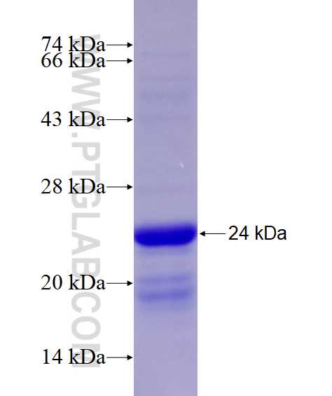 Ninein fusion protein Ag14652 SDS-PAGE