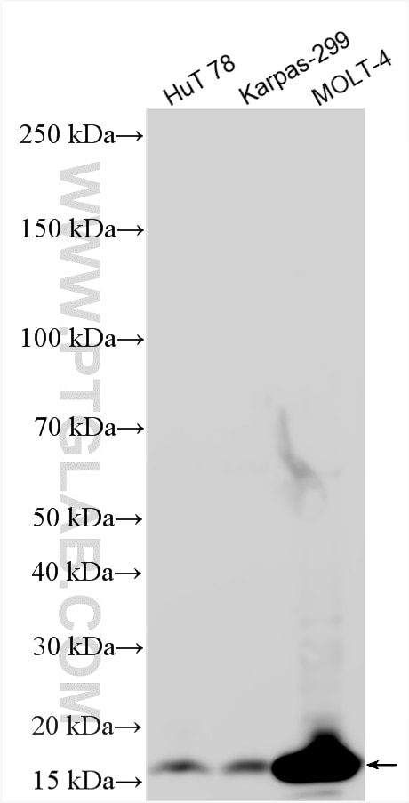 Western Blot (WB) analysis of various lysates using NINJ2 Polyclonal antibody (14085-1-AP)