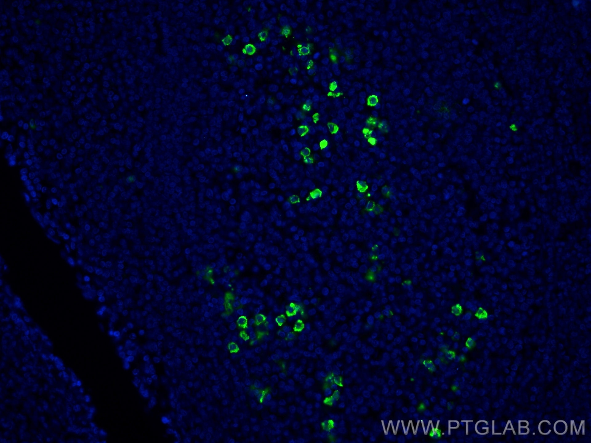 Immunofluorescence (IF) / fluorescent staining of human tonsillitis tissue using NINJ2 Monoclonal antibody (66202-1-Ig)
