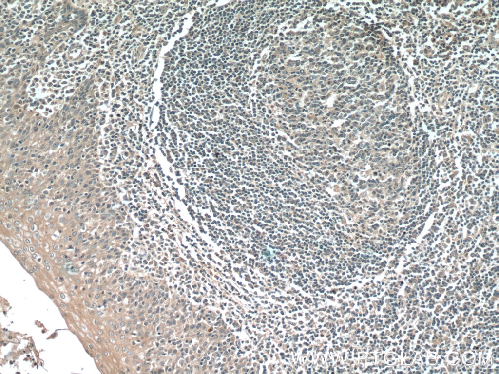 Immunohistochemistry (IHC) staining of human tonsillitis tissue using NINJ2 Monoclonal antibody (66202-1-Ig)