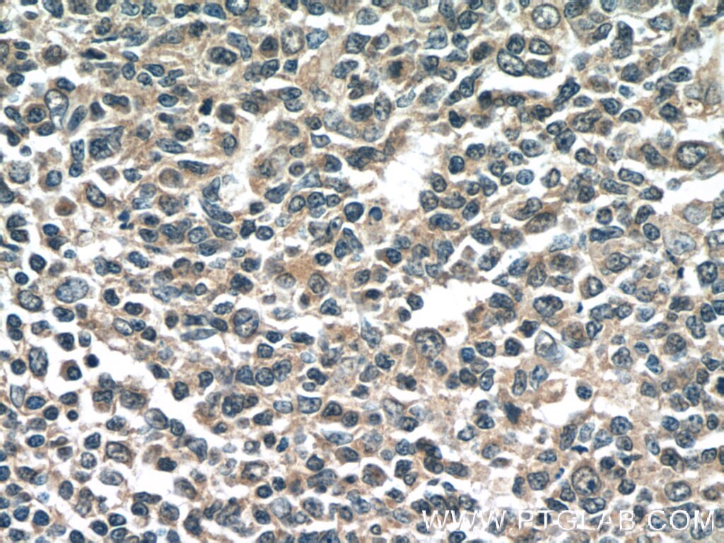 Immunohistochemistry (IHC) staining of human tonsillitis tissue using NINJ2 Monoclonal antibody (66202-1-Ig)