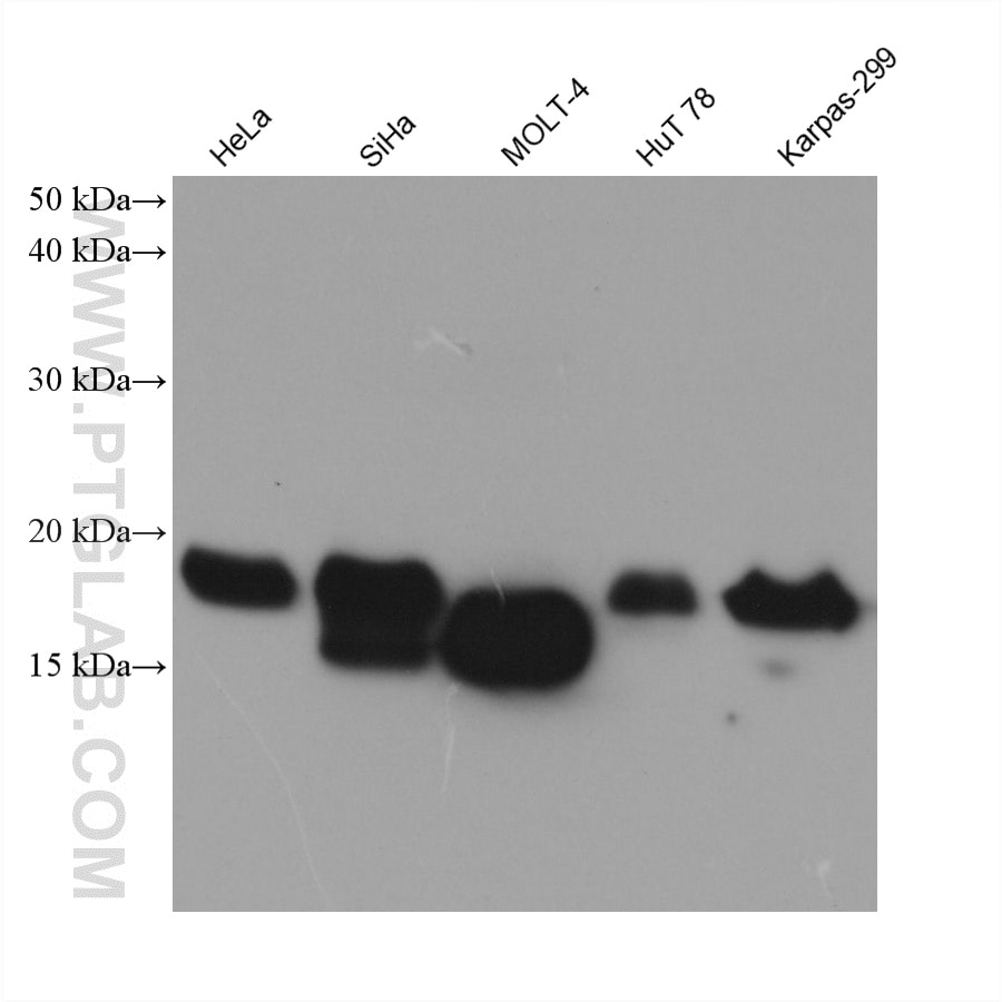 Western Blot (WB) analysis of various lysates using NINJ2 Monoclonal antibody (66202-1-Ig)
