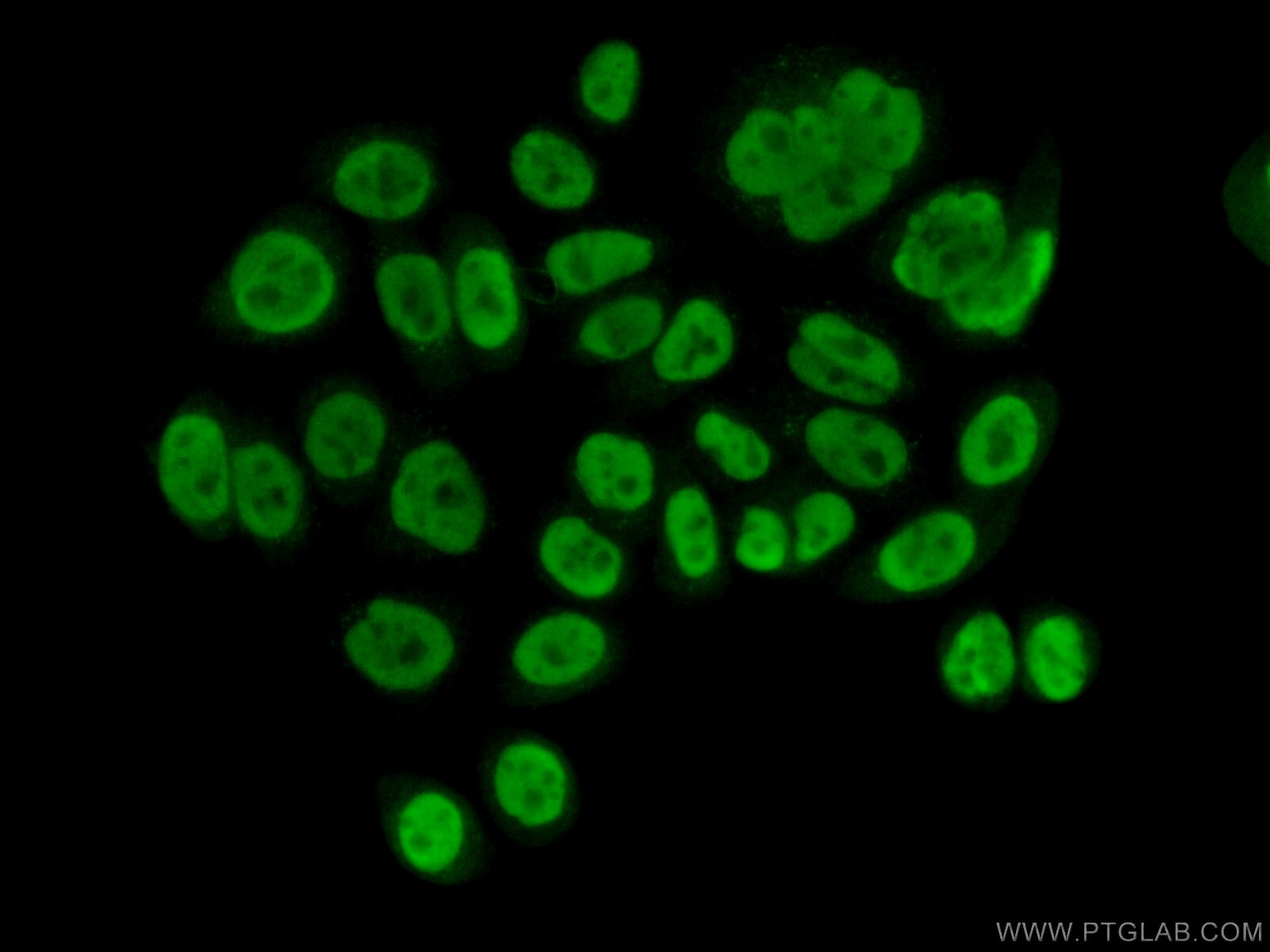 Immunofluorescence (IF) / fluorescent staining of HeLa cells using NIP30 Polyclonal antibody (16830-1-AP)