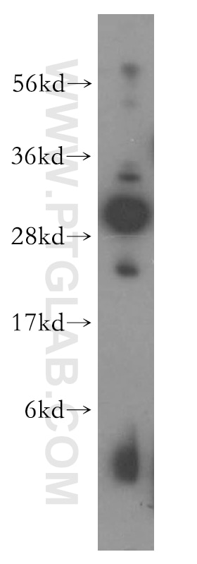 Western Blot (WB) analysis of HeLa cells using NIP30 Polyclonal antibody (16830-1-AP)