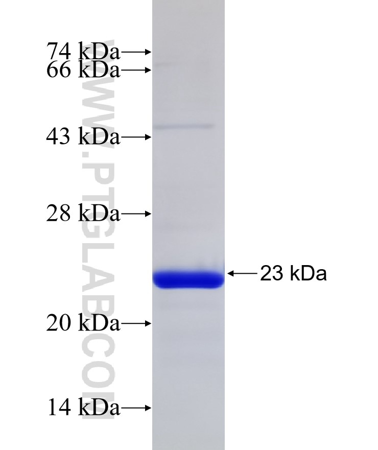 NIP7 fusion protein Ag10505 SDS-PAGE