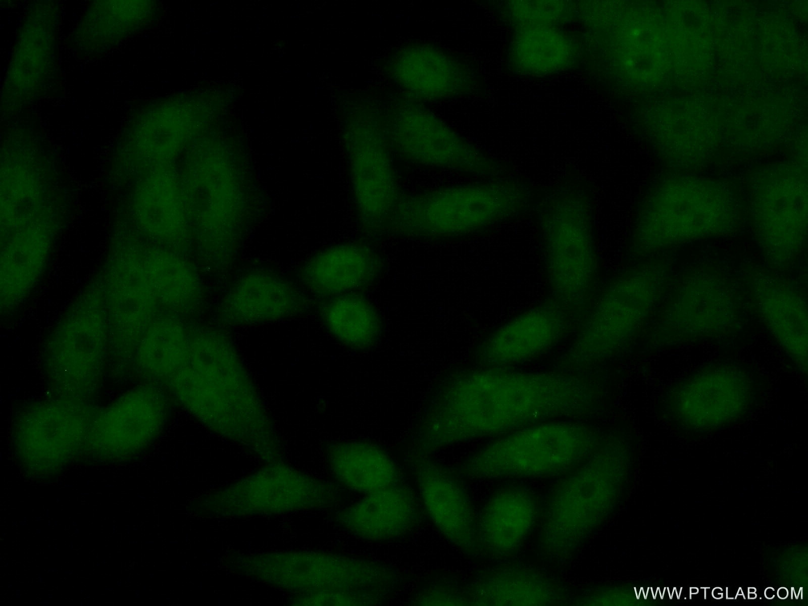 Immunofluorescence (IF) / fluorescent staining of HeLa cells using NIPBL Polyclonal antibody (18792-1-AP)