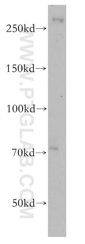 Western Blot (WB) analysis of HeLa cells using NIPBL Polyclonal antibody (18792-1-AP)
