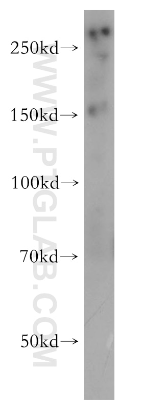 Western Blot (WB) analysis of HeLa cells using NIPBL Polyclonal antibody (18792-1-AP)