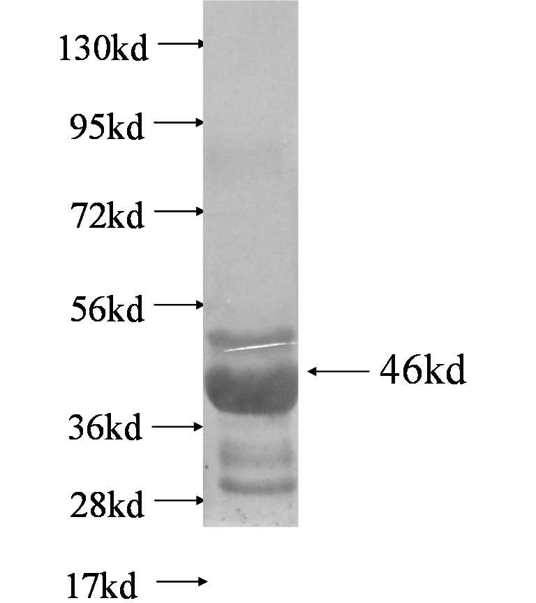 NIPBL fusion protein Ag4244 SDS-PAGE