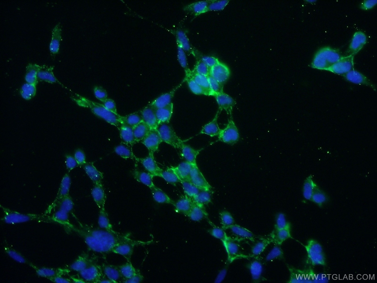 Immunofluorescence (IF) / fluorescent staining of HEK-293 cells using NIPSNAP3A Polyclonal antibody (10751-1-AP)