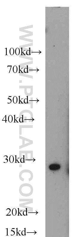 WB analysis of COLO 320 using 10751-1-AP