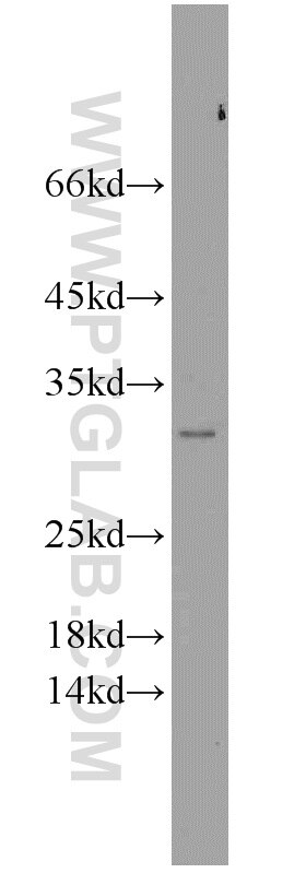Western Blot (WB) analysis of HEK-293 cells using NIPSNAP3A Polyclonal antibody (10751-1-AP)