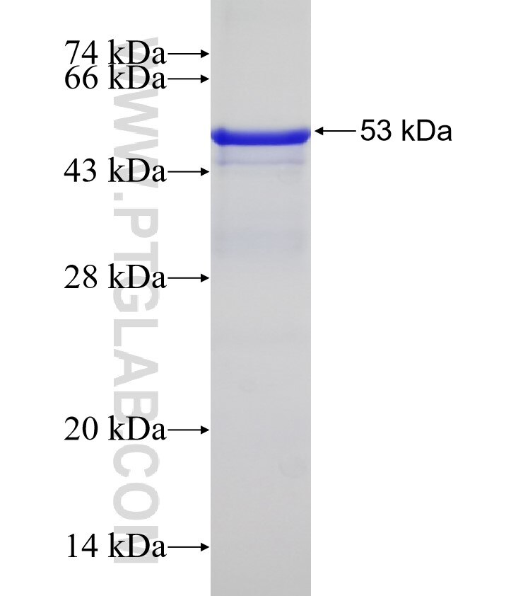 NIPSNAP3B fusion protein Ag2377 SDS-PAGE