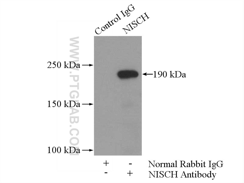 Immunoprecipitation (IP) experiment of mouse brain tissue using NISCH Polyclonal antibody (13813-1-AP)