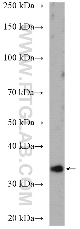 WB analysis of HeLa using 14380-1-AP