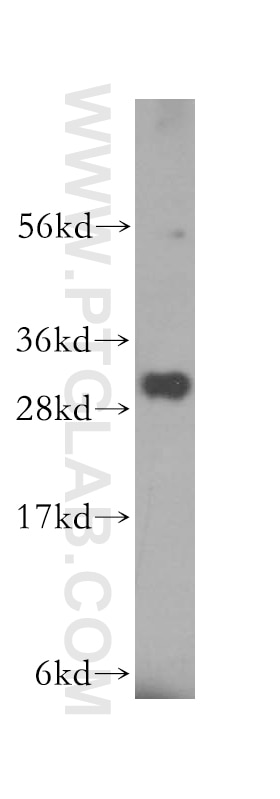 Western Blot (WB) analysis of human kidney tissue using NIT2 Polyclonal antibody (16438-1-AP)