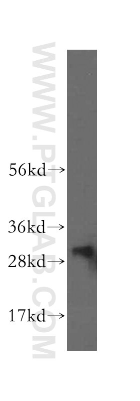 Western Blot (WB) analysis of human heart tissue using NIT2 Polyclonal antibody (16438-1-AP)