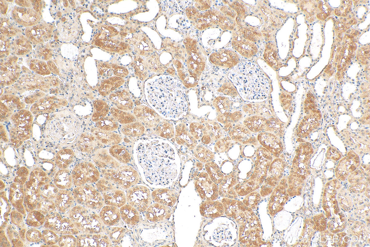 Immunohistochemistry (IHC) staining of human kidney tissue using NIT2 Monoclonal antibody (68169-1-Ig)