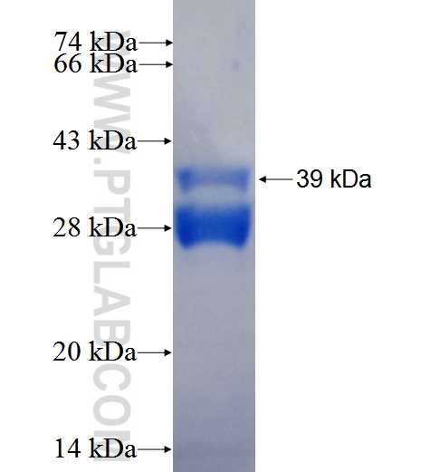 NKAP fusion protein Ag26637 SDS-PAGE