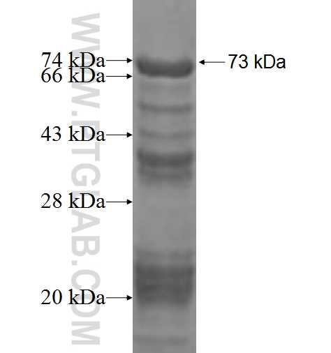 NKAP fusion protein Ag2894 SDS-PAGE