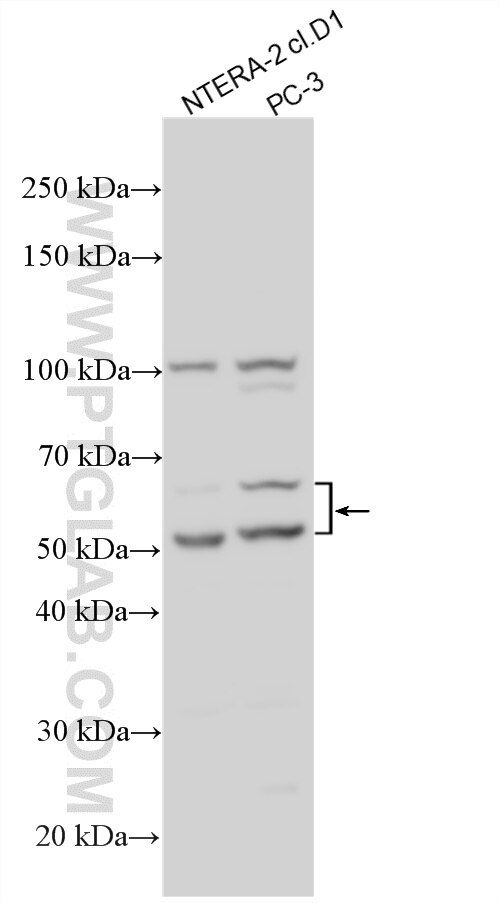 WB analysis using 26993-1-AP (same clone as 26993-1-PBS) Western Blot (WB) analysis of various lysates using NKAPL Polyclonal antibody (26993-1-AP)