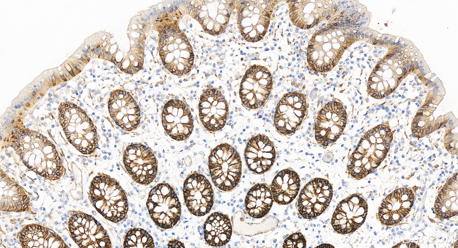 Immunohistochemical analysis of paraffin-embedded human colon tissue slide using 86201-1-RR (NKCC1/SLC12A2 antibody) at dilution of 1:500 (under 20x lens). Heat mediated antigen retrieval with Tris-EDTA buffer (pH 9.0). Immunohistochemistry (IHC) staining of human colon tissue using NKCC1/SLC12A2 Recombinant antibody (86201-1-RR)