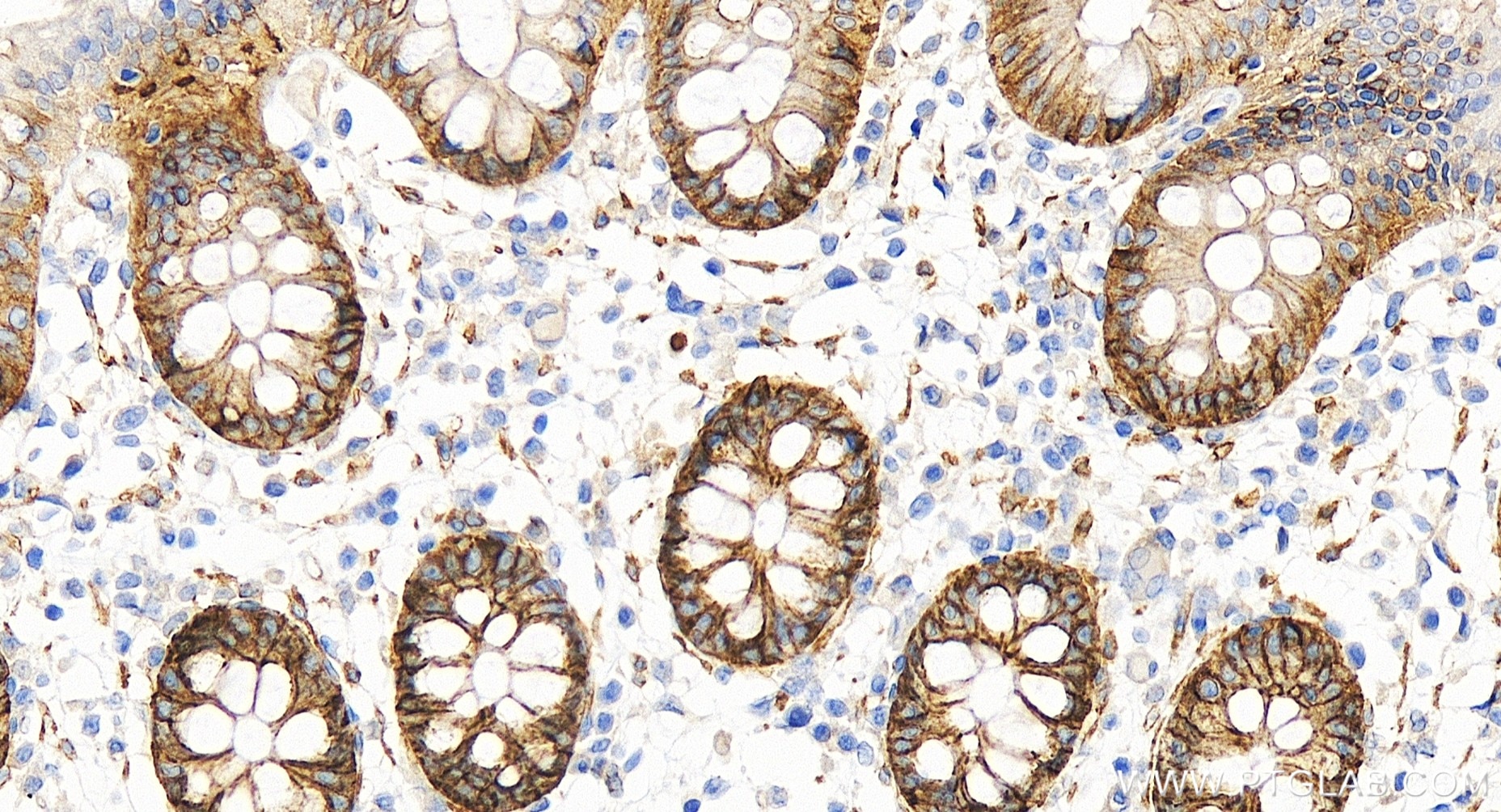 Immunohistochemical analysis of paraffin-embedded human colon tissue slide using 86201-1-RR (NKCC1/SLC12A2 antibody) at dilution of 1:500 (under 40x lens). Heat mediated antigen retrieval with Tris-EDTA buffer (pH 9.0). Immunohistochemistry (IHC) staining of human colon tissue using NKCC1/SLC12A2 Recombinant antibody (86201-1-RR)