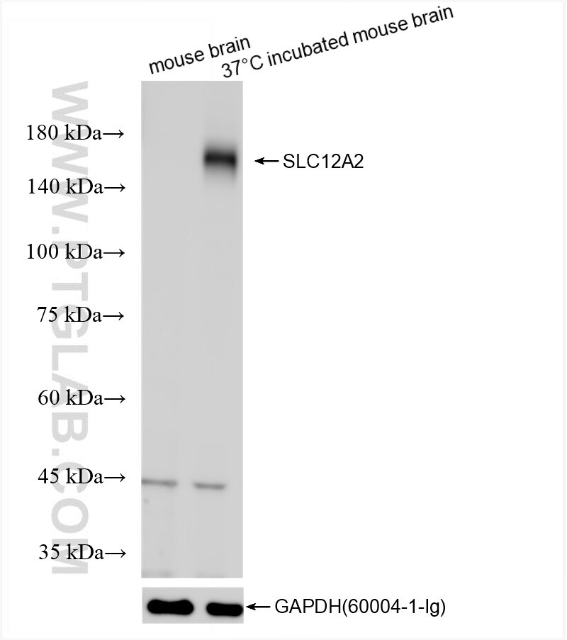 Various lysates were subjected to SDS PAGE followed by western blot with 86201-1-RR (NKCC1/SLC12A2 antibody) at dilution of 1:2000 incubated at room temperature for 1.5 hours. Western Blot (WB) analysis of various lysates using NKCC1/SLC12A2 Recombinant antibody (86201-1-RR)