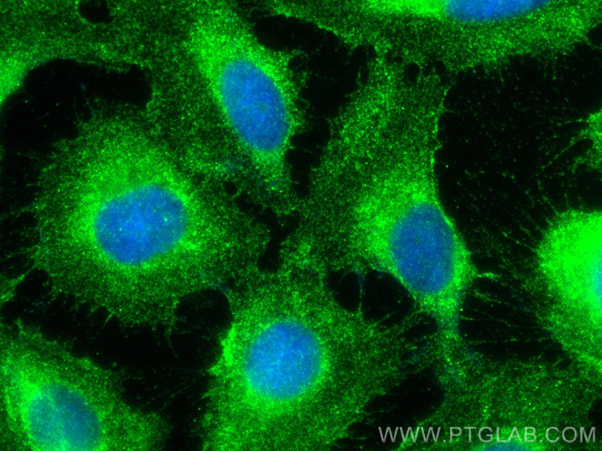 Immunofluorescence (IF) / fluorescent staining of U2OS cells using CoraLite® Plus 488-conjugated NKCC1,SLC12A2 Polycl (CL488-28055)