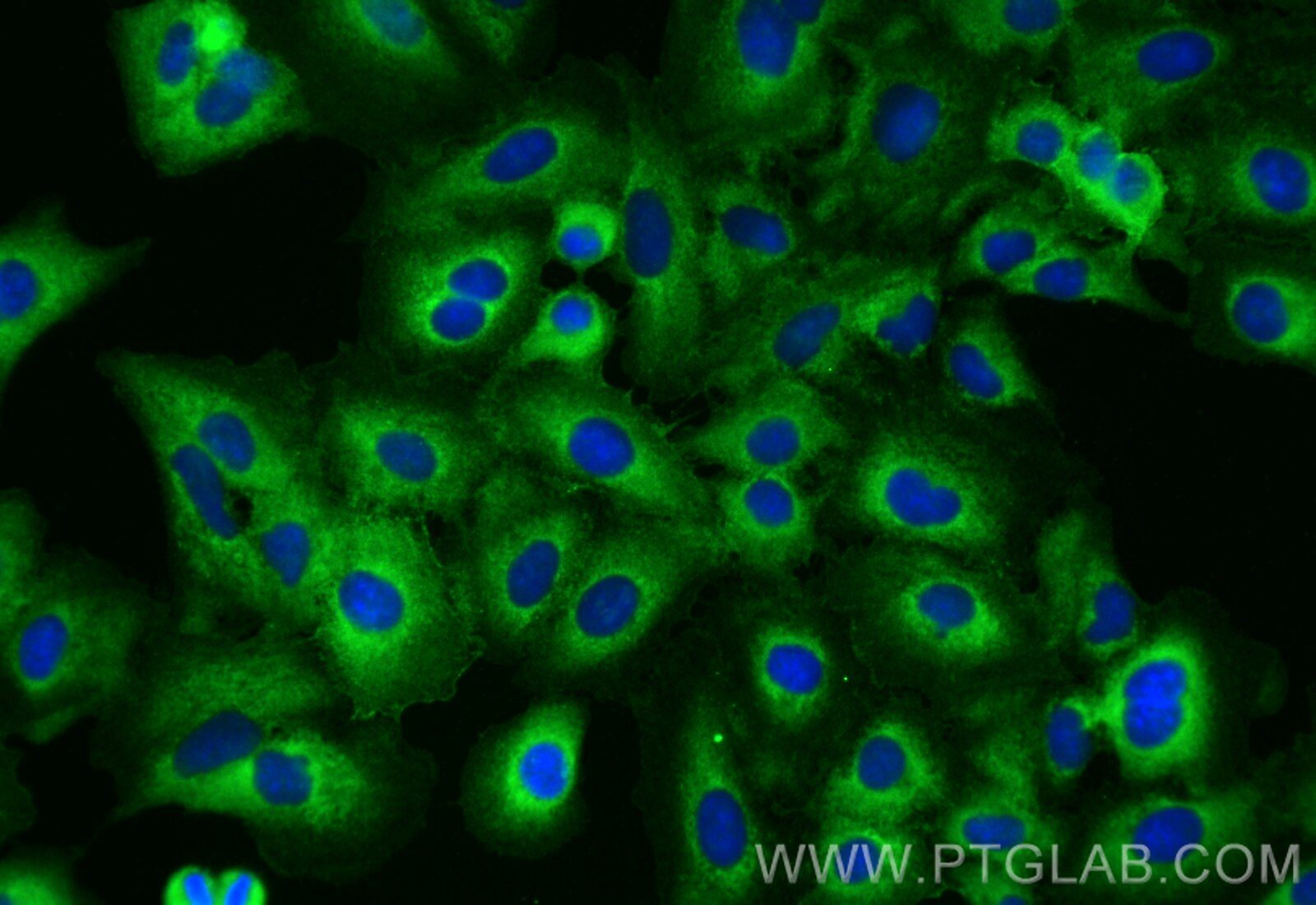 Immunofluorescence (IF) / fluorescent staining of A549 cells using CoraLite® Plus 488-conjugated NKCC1/SLC12A2 Polycl (CL488-28055)