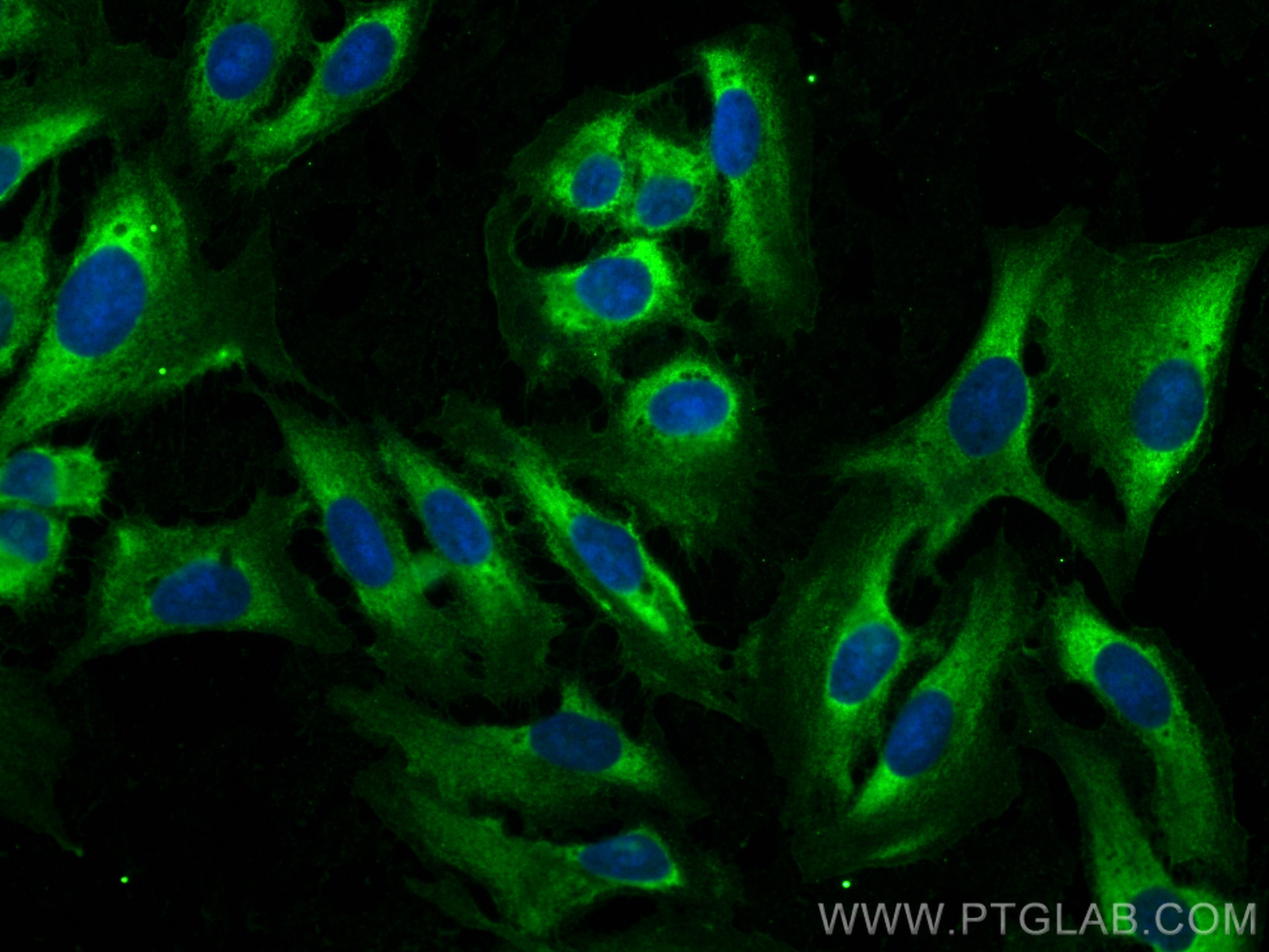 Immunofluorescence (IF) / fluorescent staining of U2OS cells using CoraLite® Plus 488-conjugated NKCC1/SLC12A2 Polycl (CL488-28055)